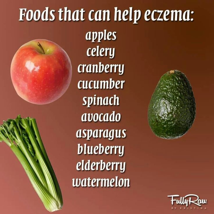 10 Foods That Can Help With Eczema : Found this ...