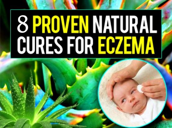 10+ images about Eczema and Dry Skin Stuff on Pinterest ...