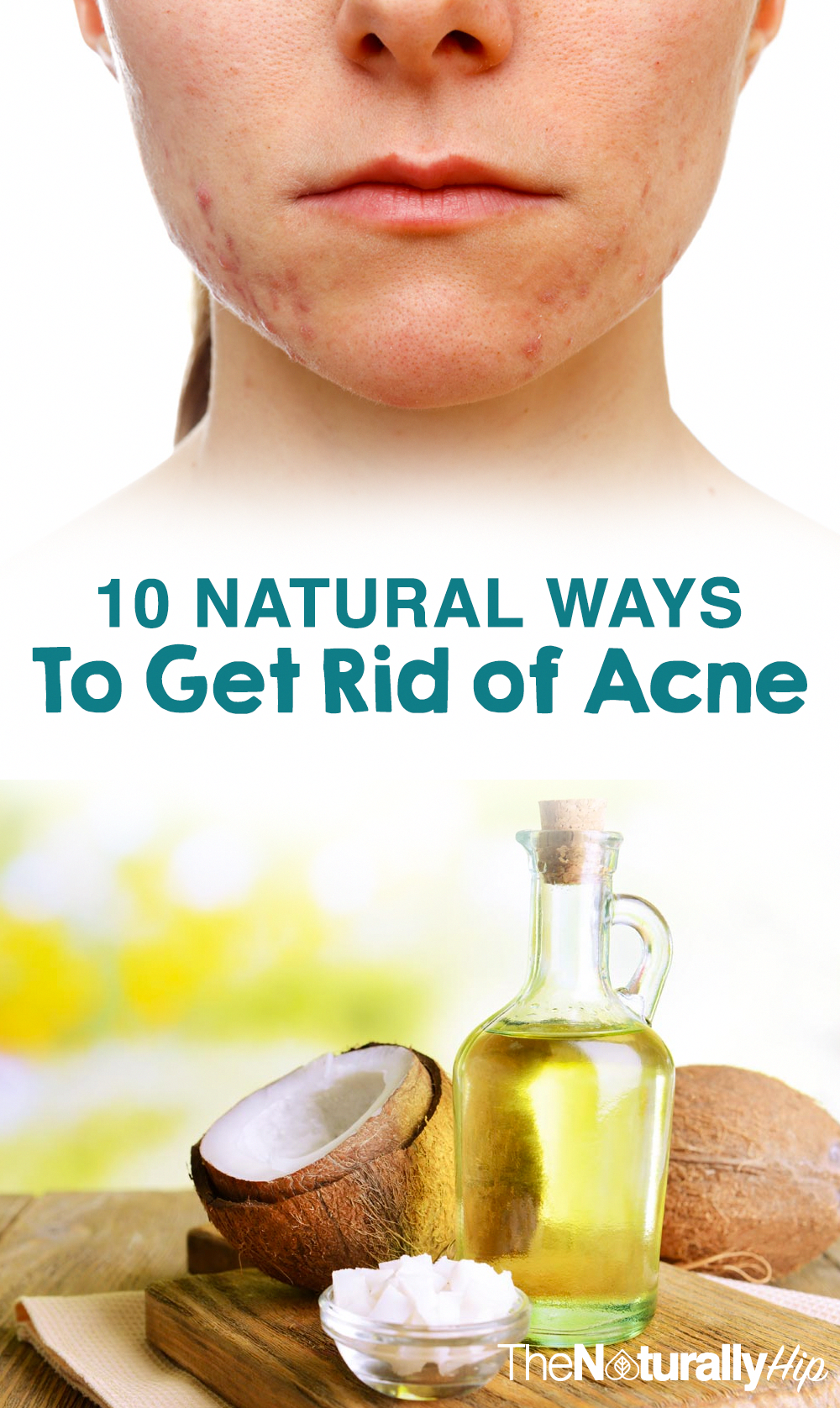 10 Natural Ways to Get Rid of Acne Fast