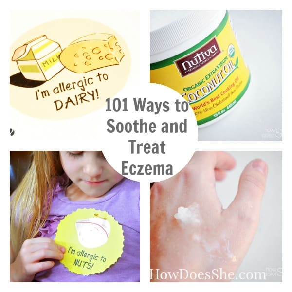 101 Ways to Soothe and Treat Eczema