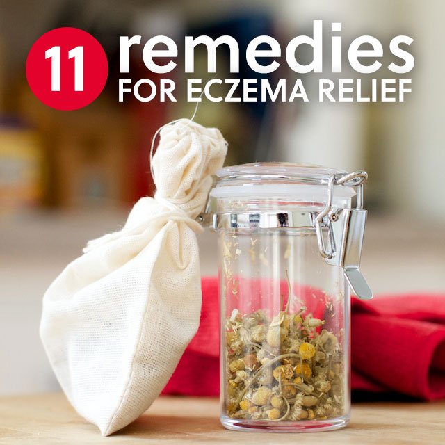 11 Healing Home Remedies for Eczema