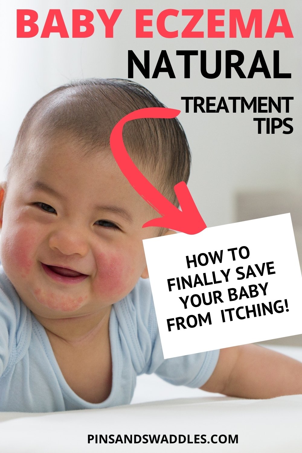 12 Proven Tips to Treat Baby Eczema Naturally