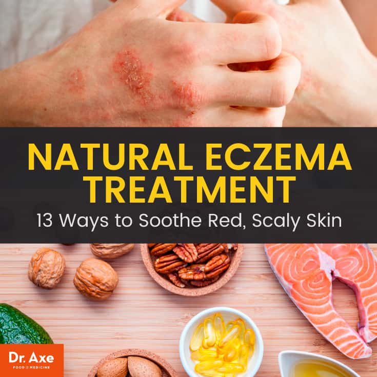 13 Best Natural Eczema Treatment Options