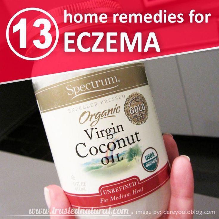 13 Home Remedies To Get Rid Of Eczema Naturally #getridofeczema
