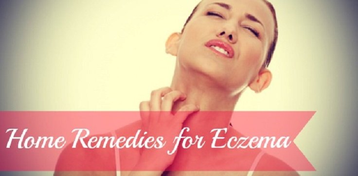 15 Best Natural Eczema Remedies, Treatments, Tips and Tricks