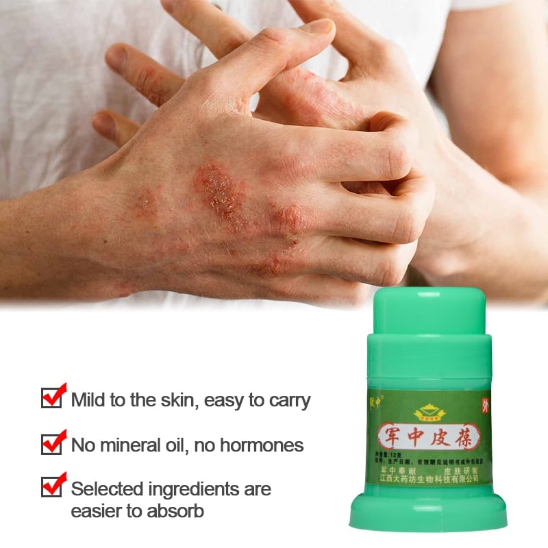 1pcs Eczema Psoriasis Ointment Dermatitis Anti Itching Pure Herbal ...