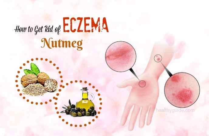 24 Tips How To Get Rid Of Eczema Rash,Scars On Legs,Arms ...