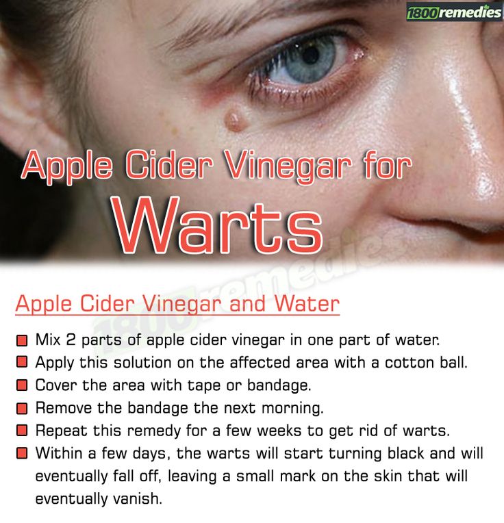 242 best images about Home Remedies on Pinterest