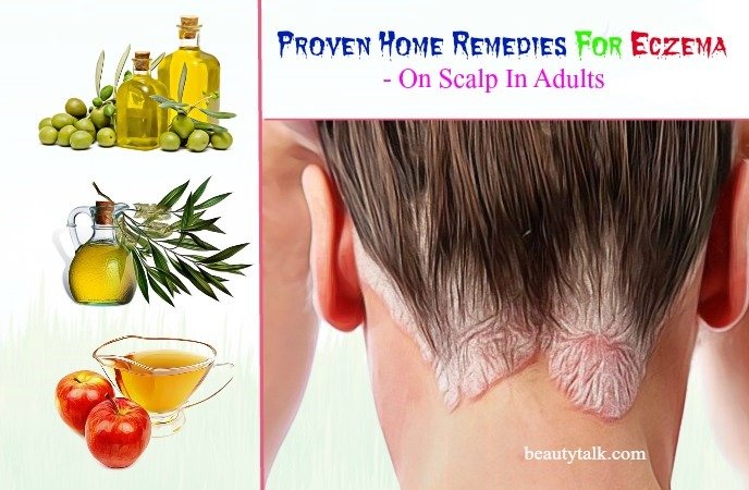 26 Proven Home Remedies For Eczema On Scalp In Adults &  Kids
