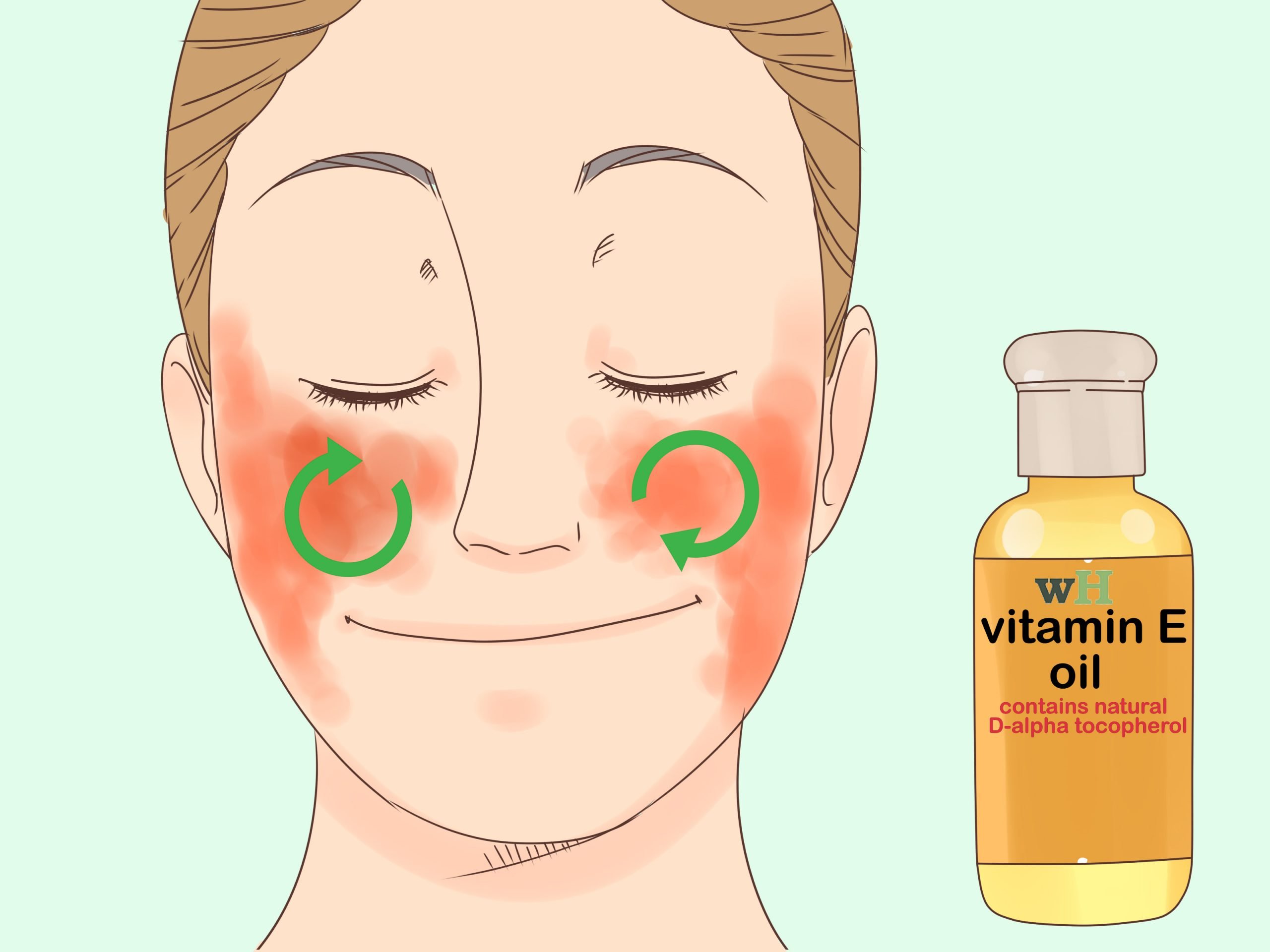 3 Ways to Treat Face Eczema