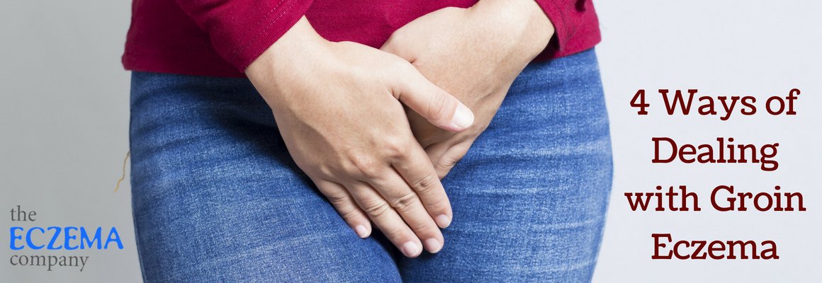 4 Ways of Dealing with Groin Eczema