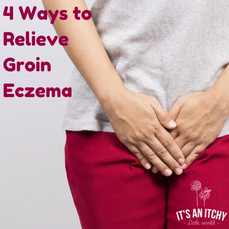 4 Ways to Relieve Groin Eczema