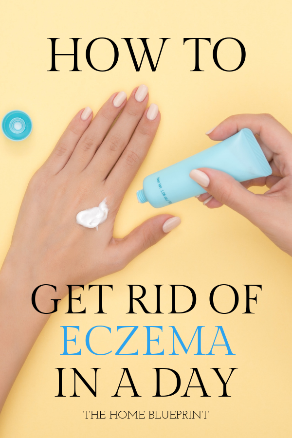 How To Cure Severe Eczema Fast