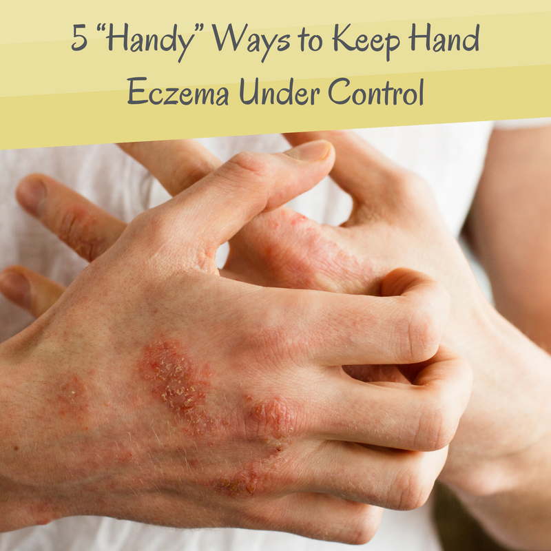 5 Handy? Ways to Keep Hand Eczema Under Control