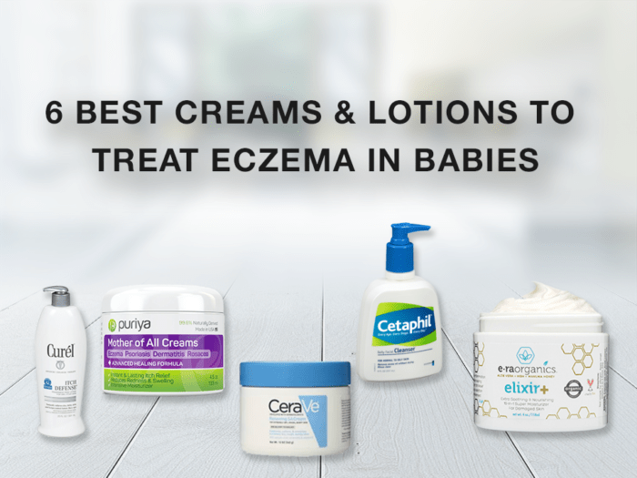 6 Best Creams &  Lotions to Treat Eczema In Babies