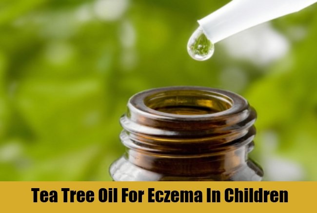 7 Best And Effective Ways To Cure Eczema In Children
