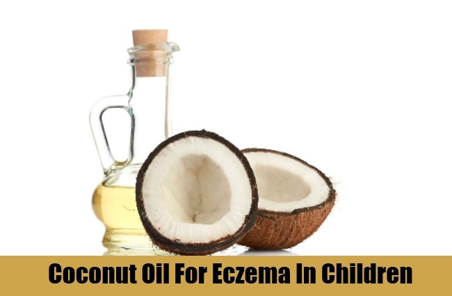 7 Best And Effective Ways To Cure Eczema In Children ...