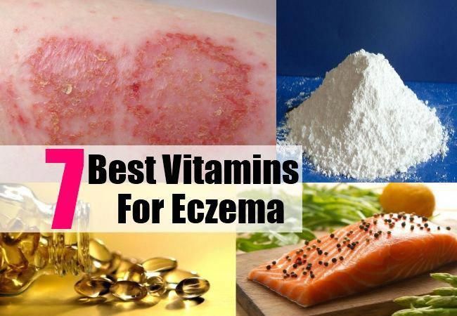 7 Best Vitamins And Supplements For Eczema