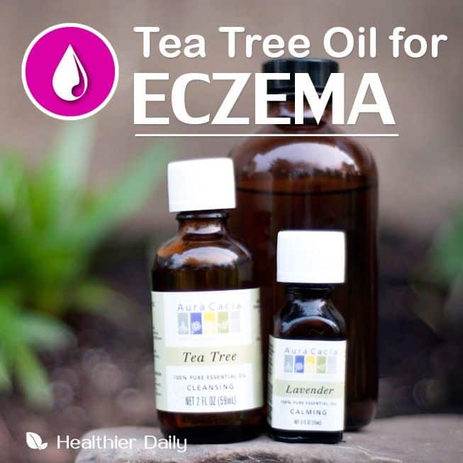 8 Essential Oils For Eczema