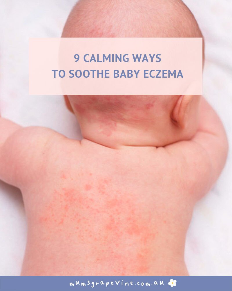 9 ways to soothe a baby with eczema