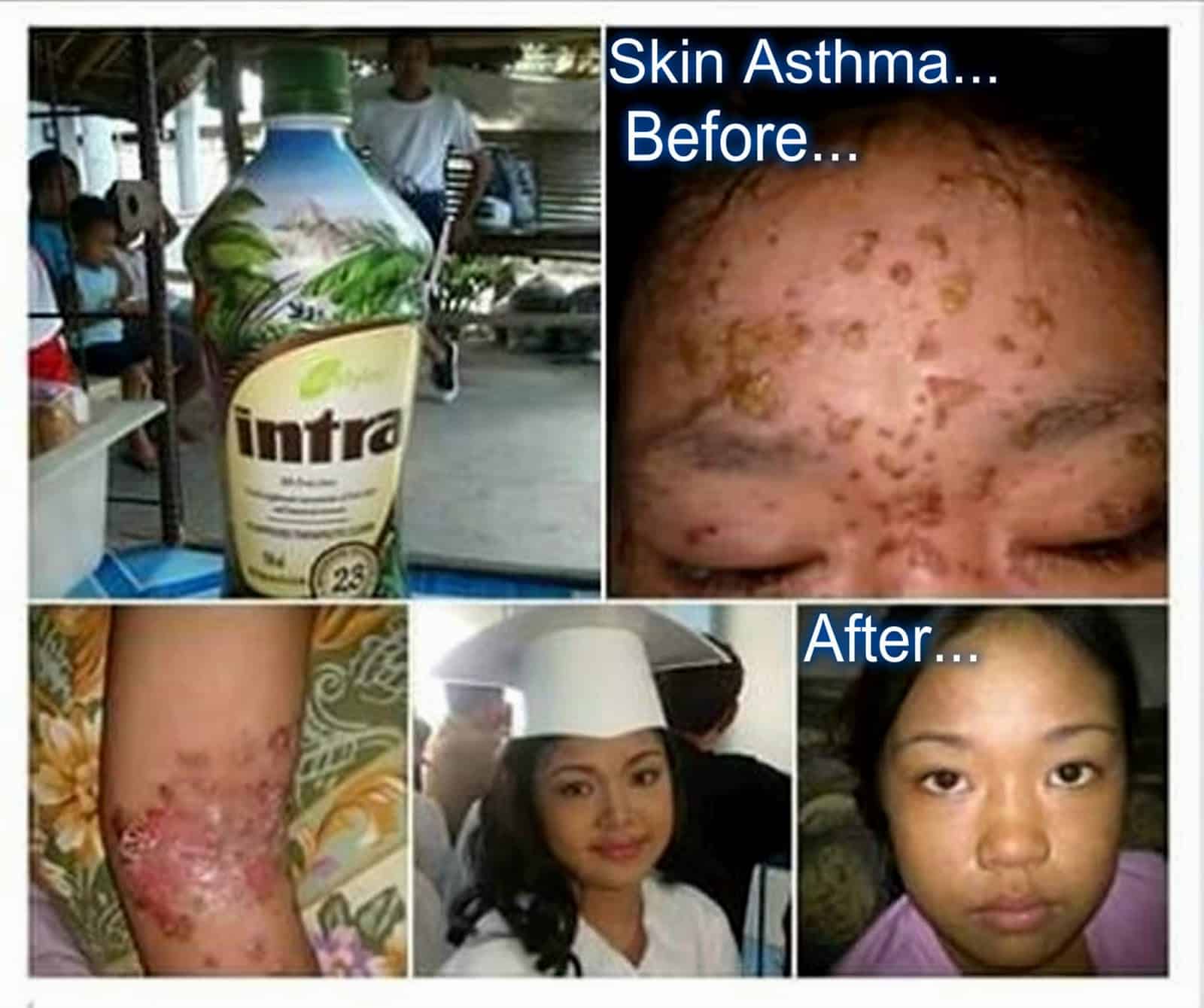 An Invite to Abundant Life: Skin Diseases? Get rid naturally with ...