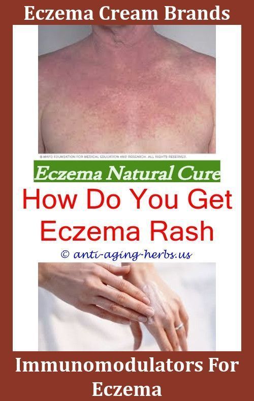 Anti Eczema Shampoo,what can cause eczema garlic for ...
