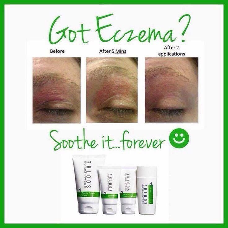 Are you ready to soothe your Eczema? Ready to get rid of the redness ...