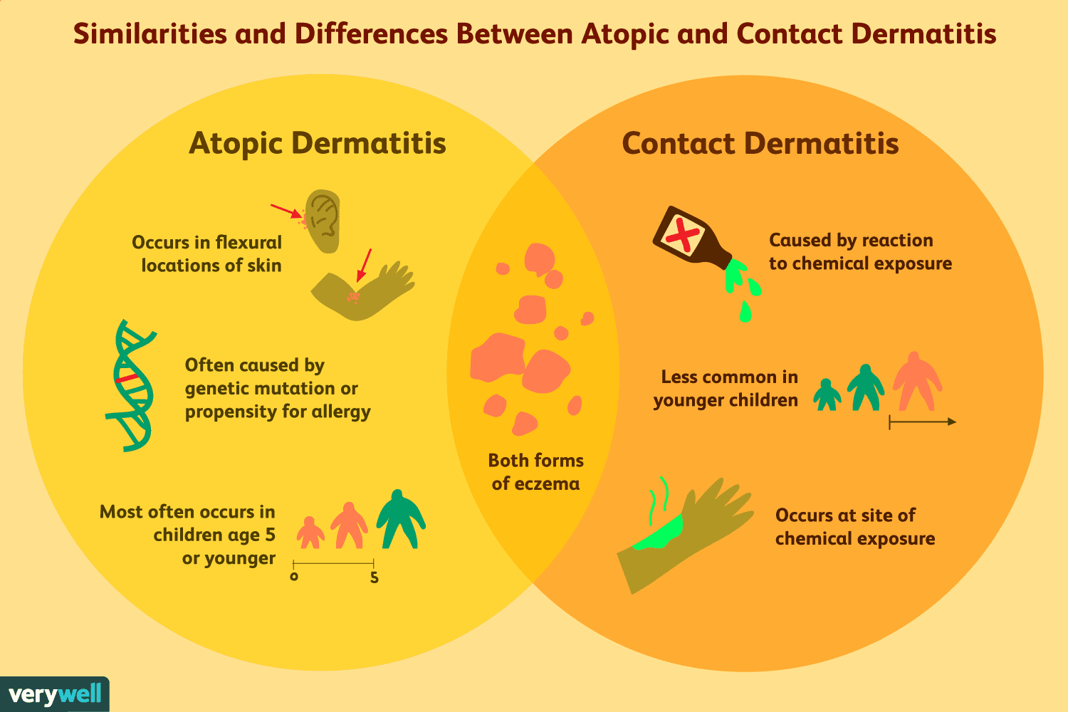 Atopic and Contact Dermatitis: How They Differ