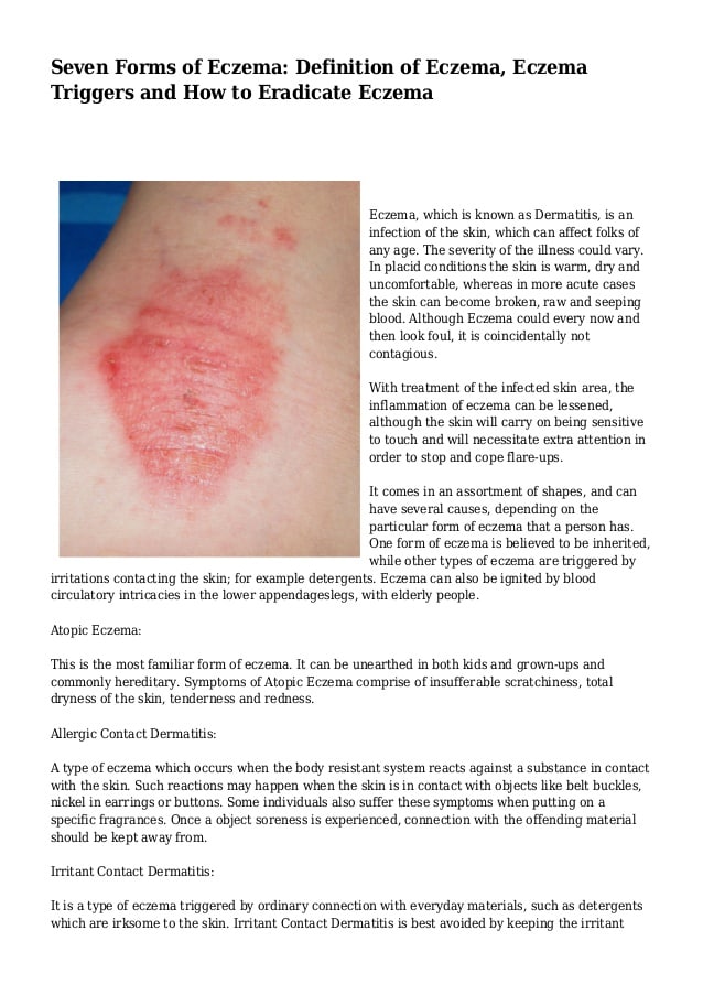 Atopic Dermatitis Like Symptoms Women Treatment Pictures ...