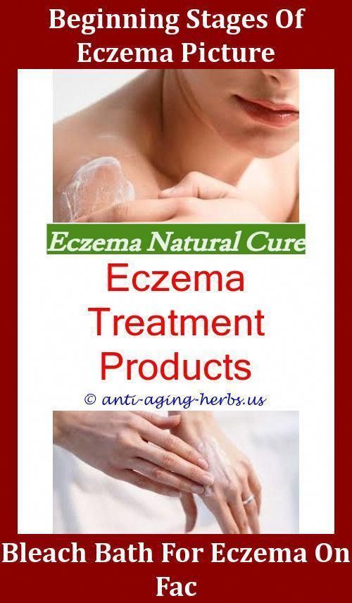 Avene Trixera Eczema,dyshidrotic eczema what is the best ...