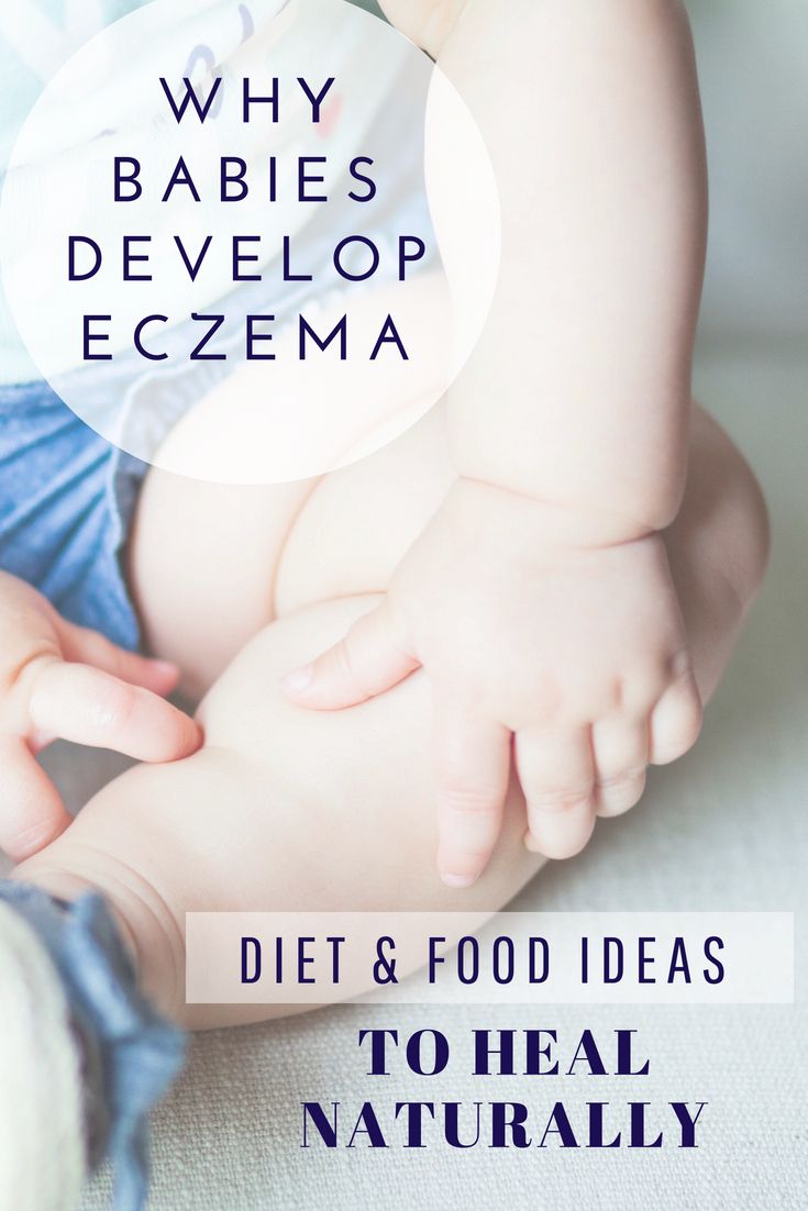 Baby Eczema Causes and Triggers, Diet And Food Recipe Ideas To Heal ...