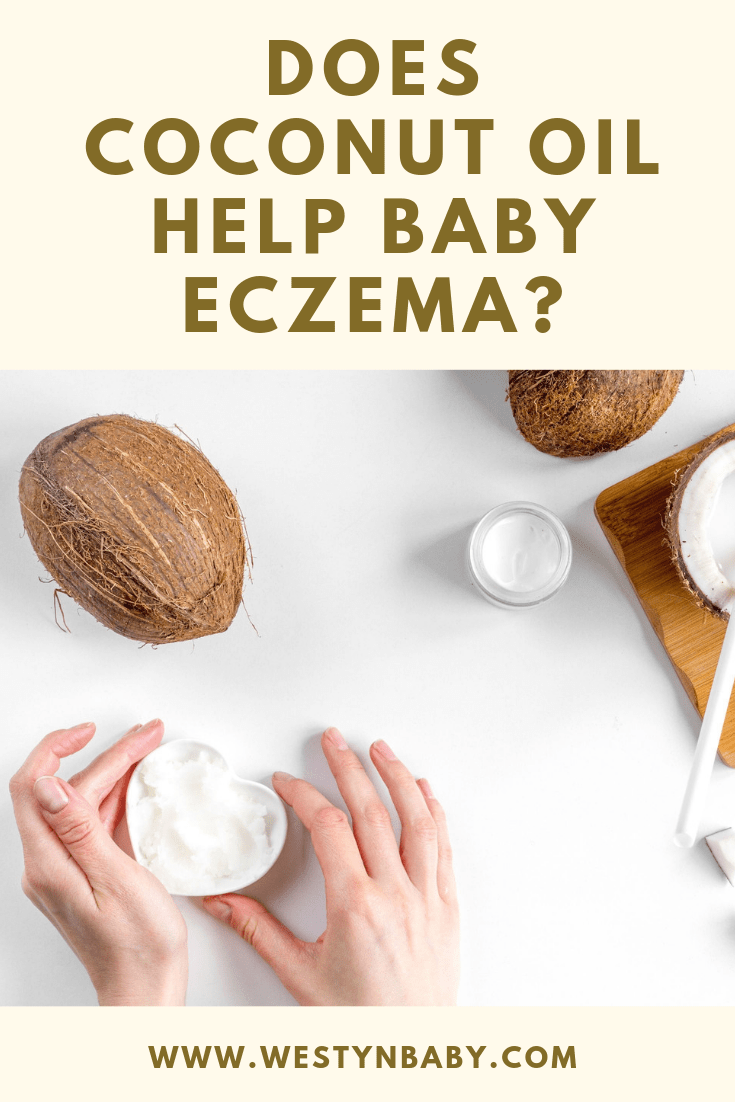Baby Eczema, Coconut Oil, and What The Research Has To Say ...