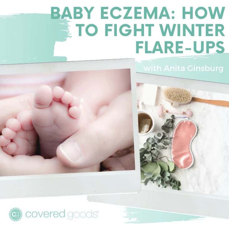 Baby Eczema: How to Fight Winter Flare