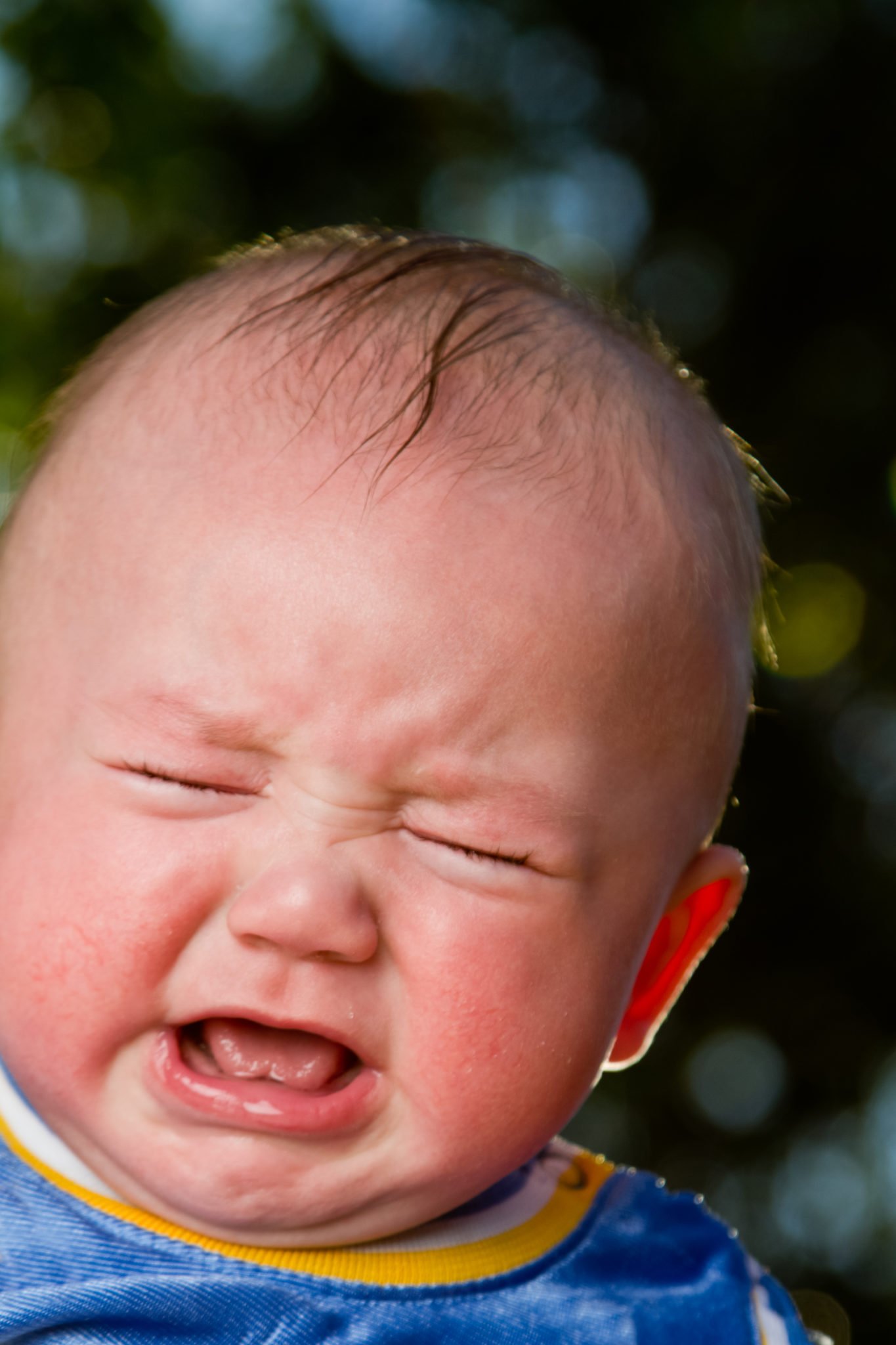 Baby Heat Rash vs Eczema: Whats the Difference