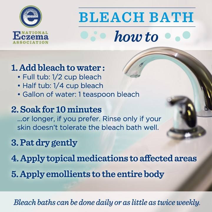 Best 25+ Bleach bath for eczema ideas on Pinterest