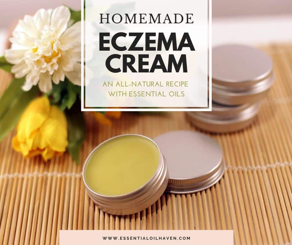 Best Essential Oils for Eczema