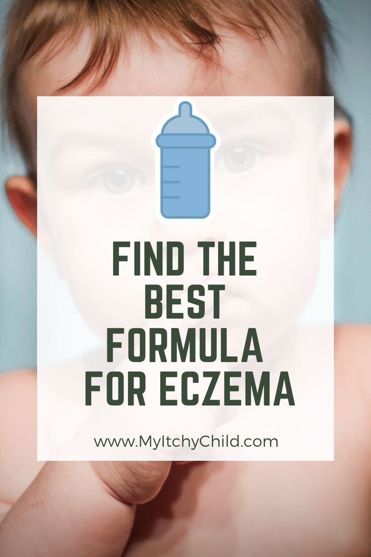 Best Formula for Babies with Eczema