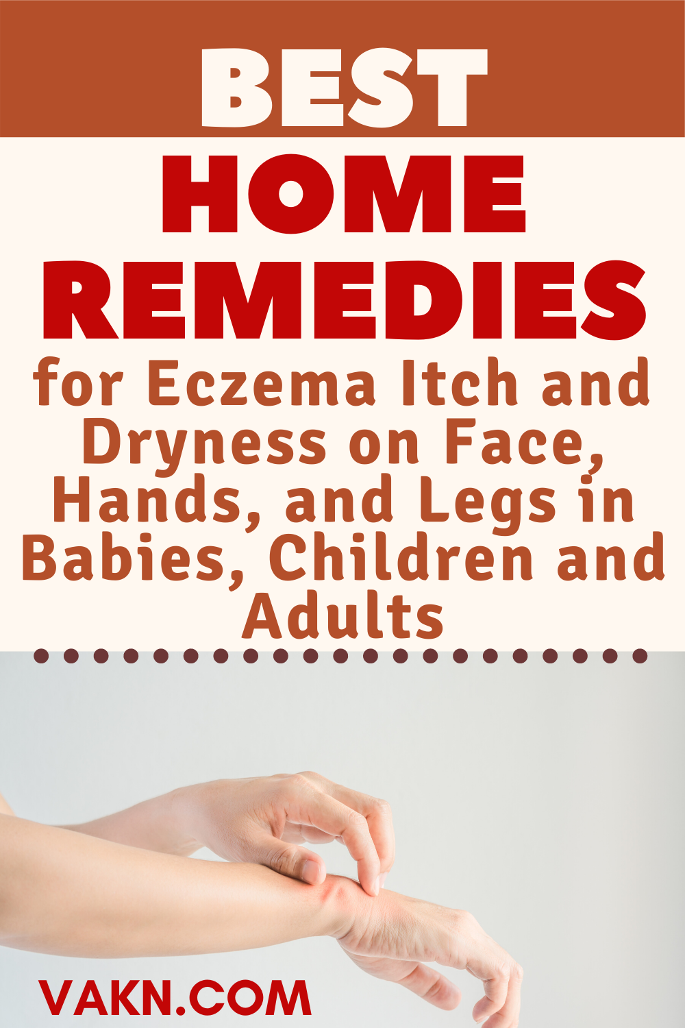 Best Home Remedies For Eczema Itch &  Dryness On Face ...