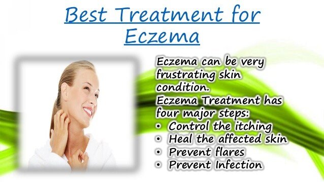 Best treatment for eczema