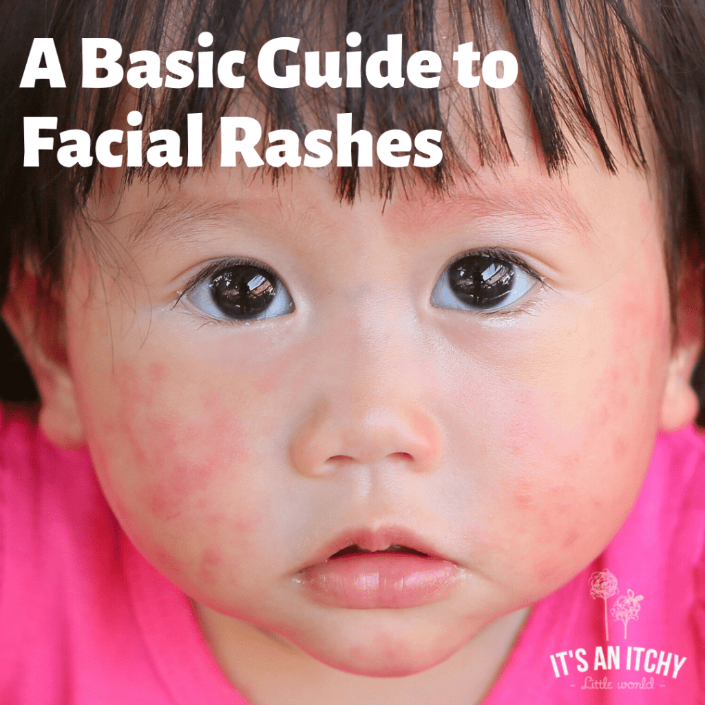 Best Treatments for Facial Rashes