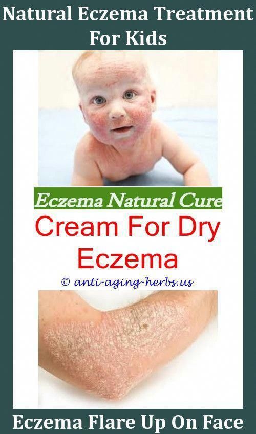 Best Way To Treat Eczema On Hands,dry skin condition ...