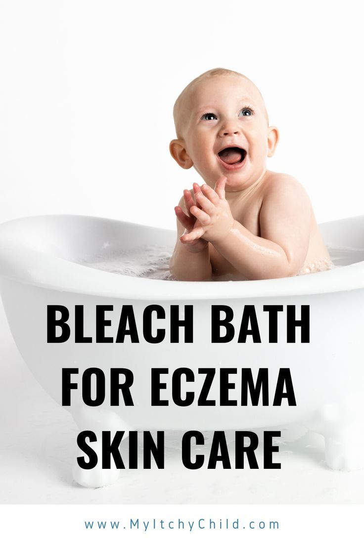 Bleach Baths for Eczema in Babies