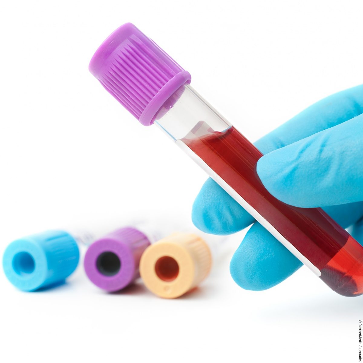 Blood test detects over 50 cancer types