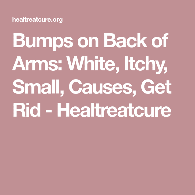 Bumps on Back of Arms: White, Itchy, Small, Causes, Get Rid ...
