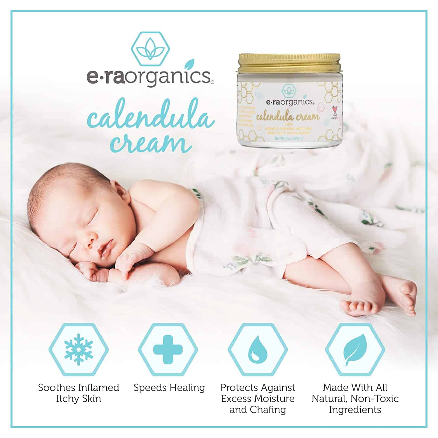 Calendula Rash &  Baby Acne Cream  Extra Soothing Moisturizing Cream ...