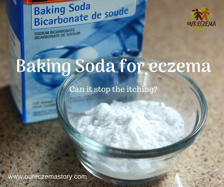 Can baking soda help your eczema? Read our full review now! Baking soda ...