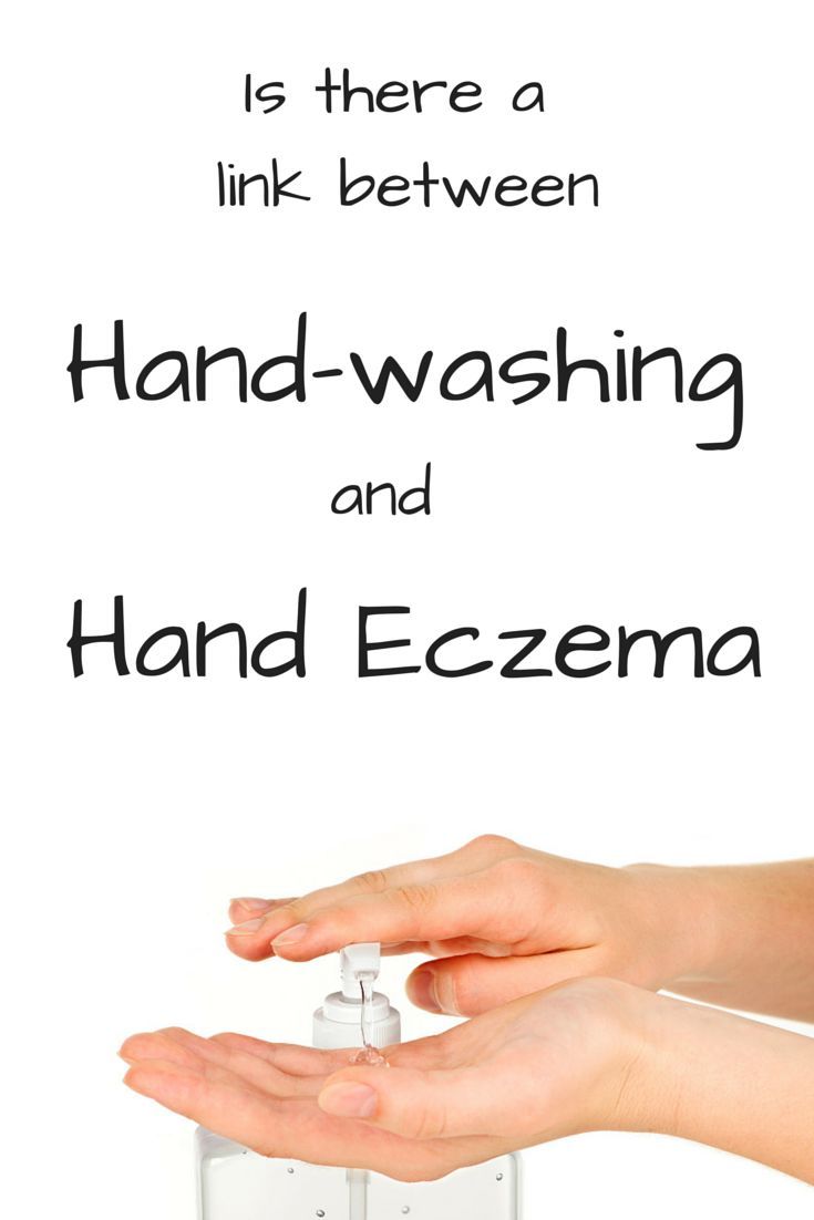 Can Washing Your Hands Too Frequently Cause Eczema ...