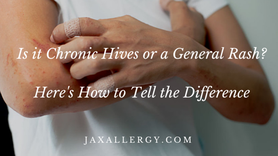 Chronic Hives or A Rash? Heres How to TellJax Allergy