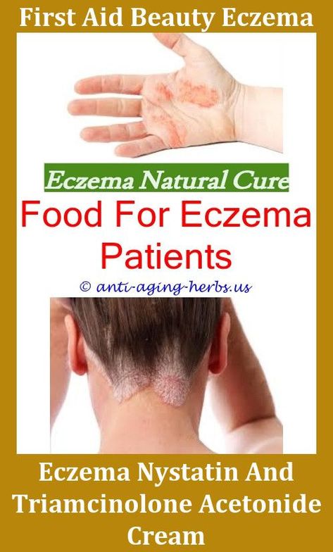 Common Causes Of Eczema Alcohol And Eczema,eczema on neck ...