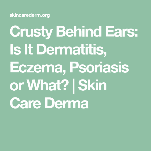 Crusty Behind Ears: Is It Dermatitis, Eczema, Psoriasis or What?